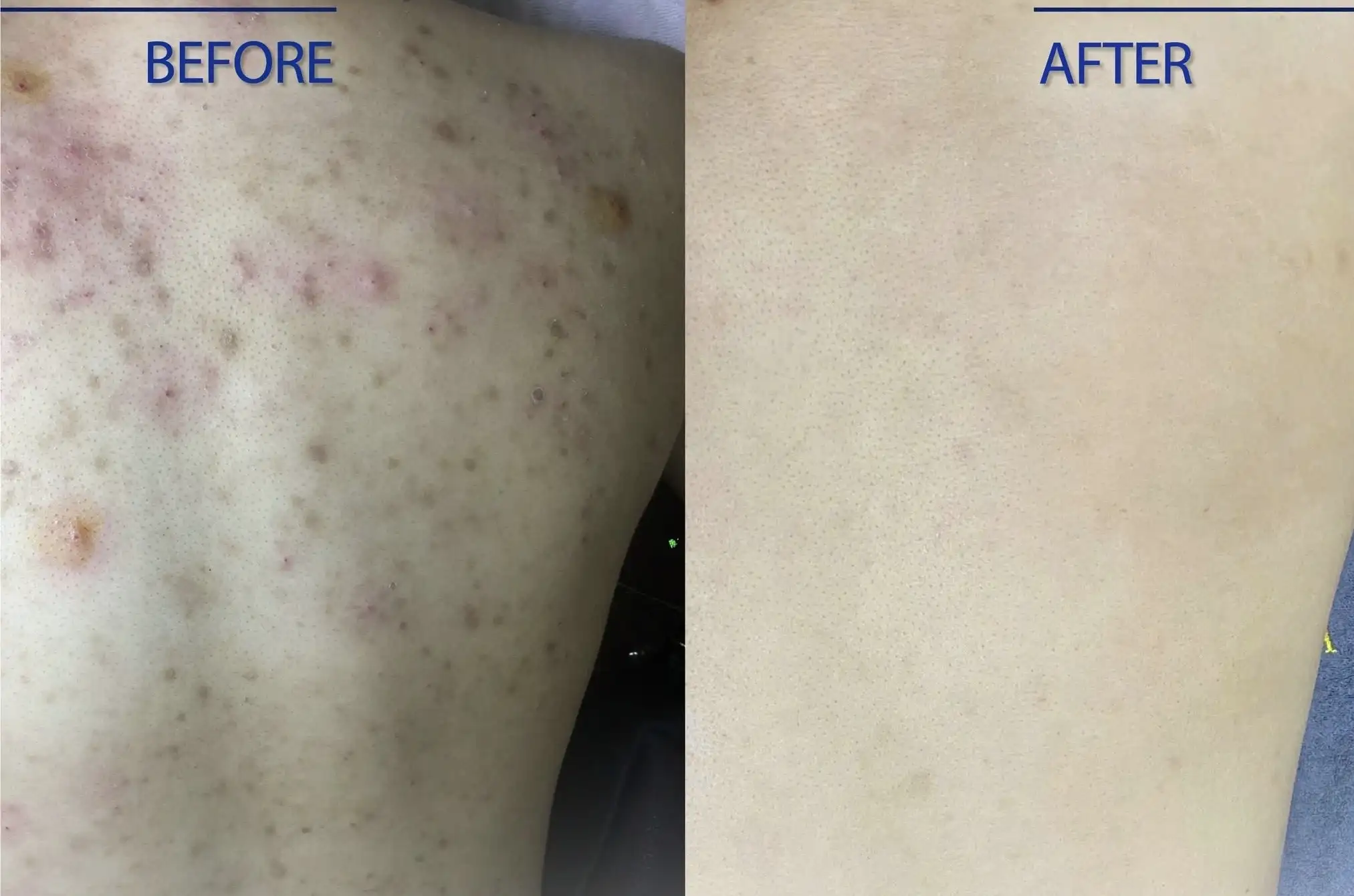 How to Choose Skincare Products for Your Skin Condition