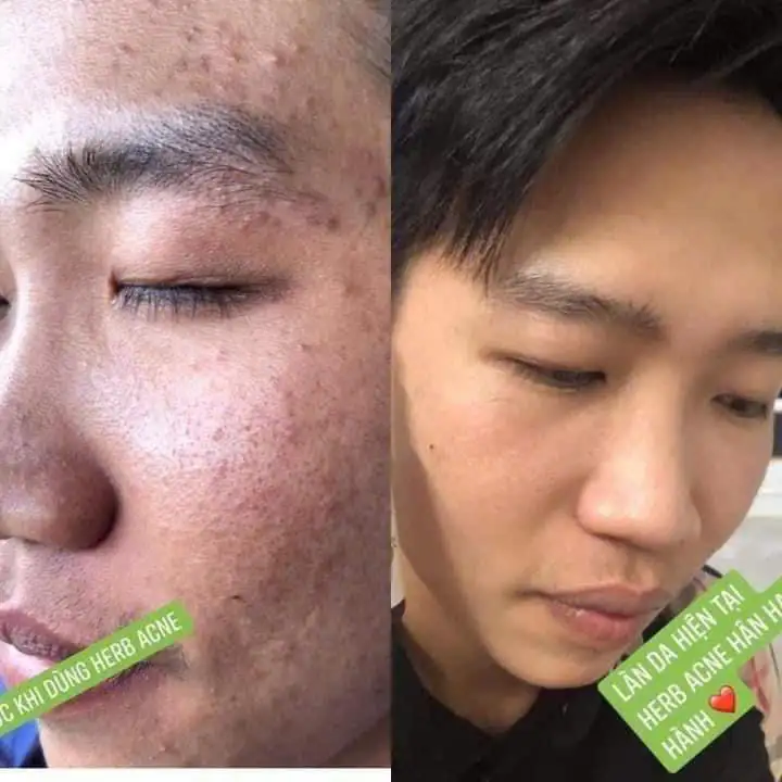 Skin Treatment Guide in Poipet