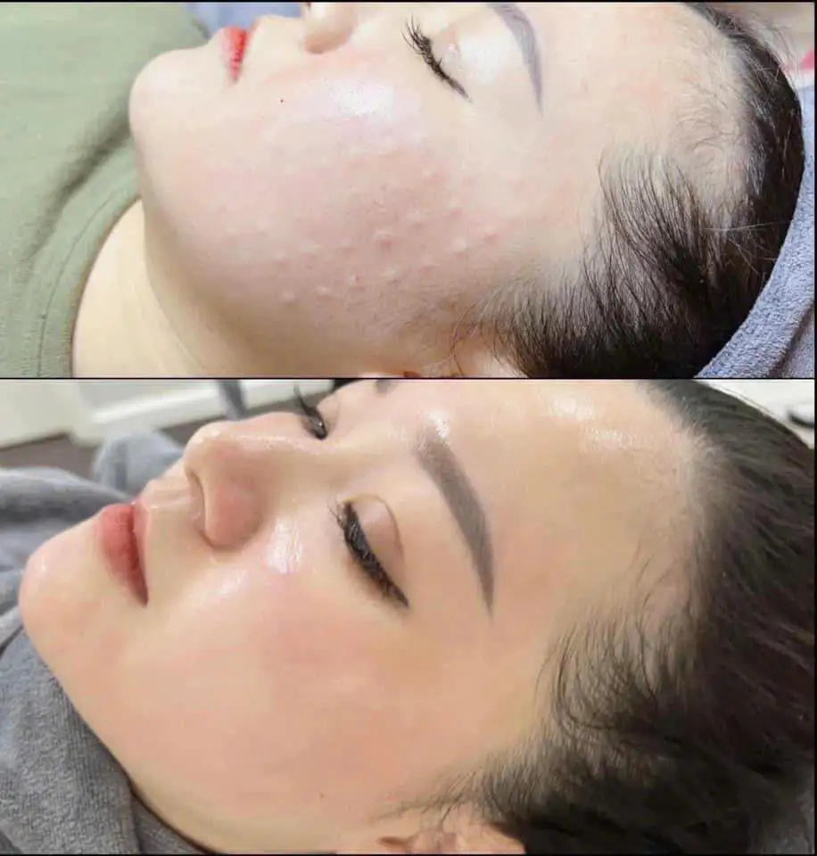 Skin Treatment Guide in Poipet