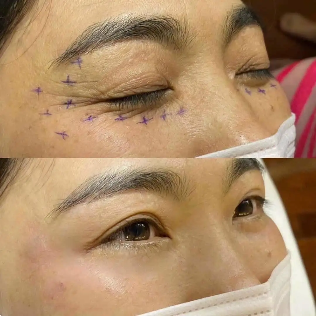 DIVA Skin Clinic Poipet