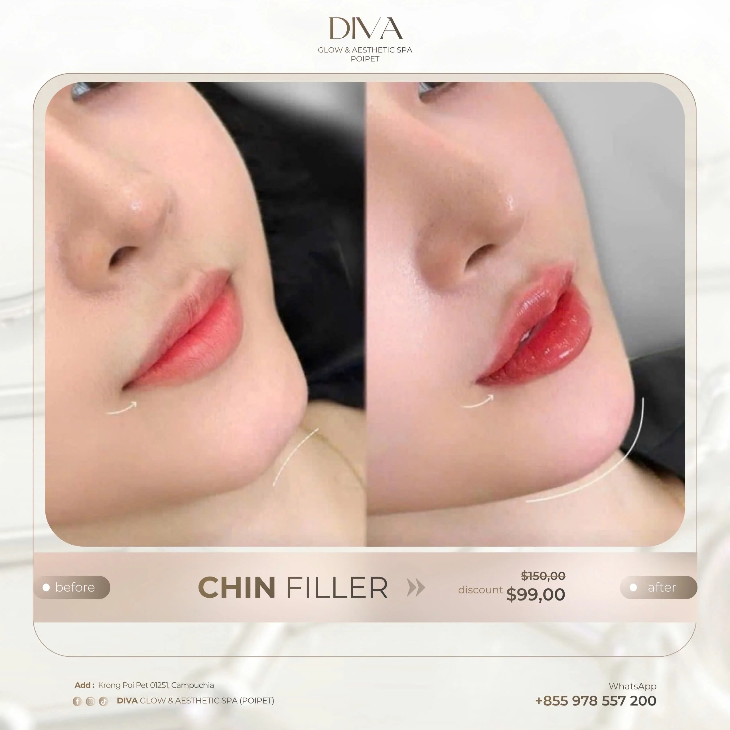 Natural Enhancement. Real, Visible Results.