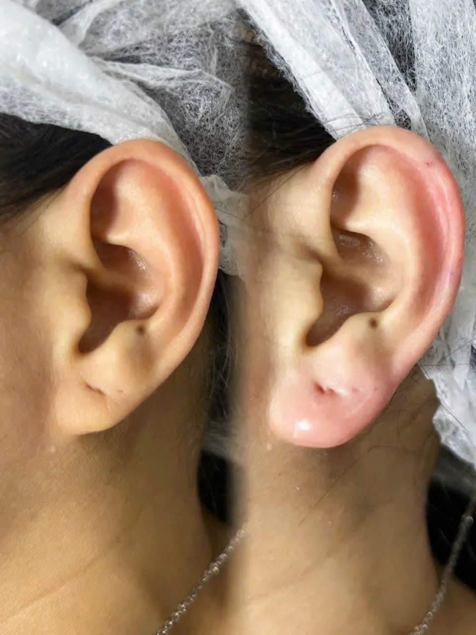 Complete Guide to Injectable Treatments in Poipet