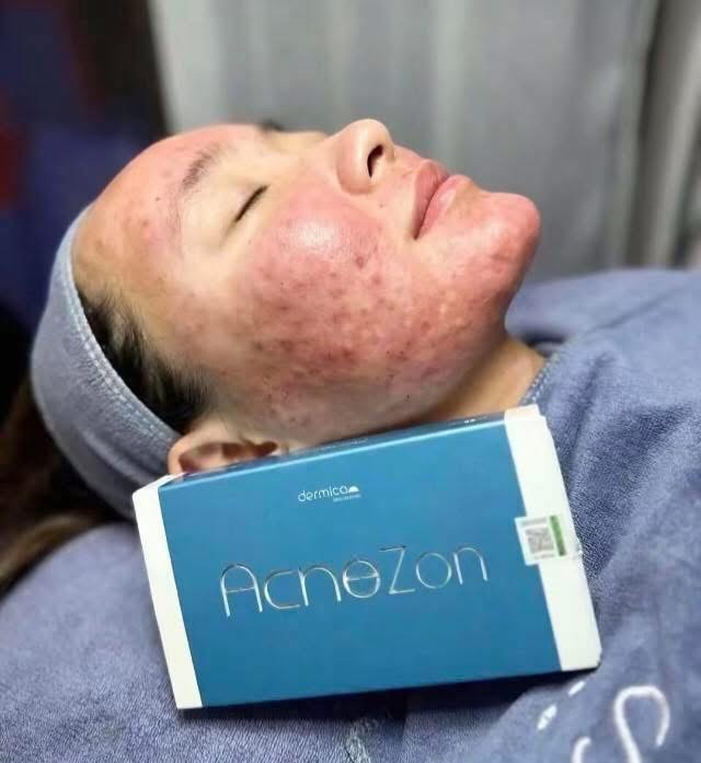 Why Clear Consultation and Aftercare Matter Before Treatment