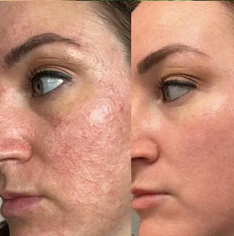 Body Concerns